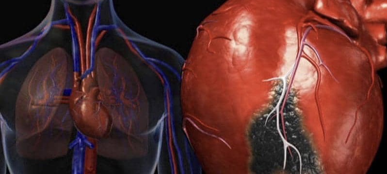 دراسة: رفع الأثقال مفيد لحرق دهون القلب