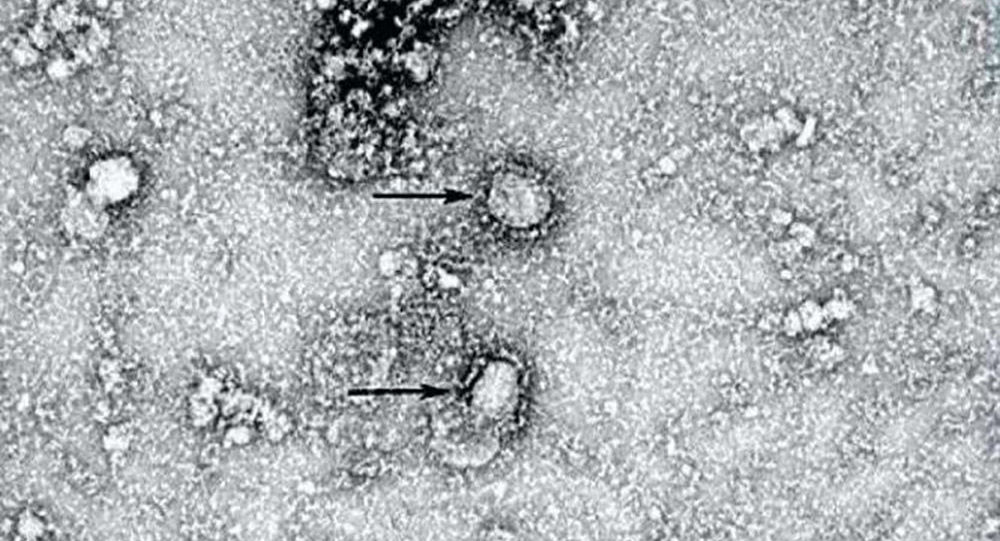 ماذا تعرف عن فيروس كورونــا الجديد ؟
