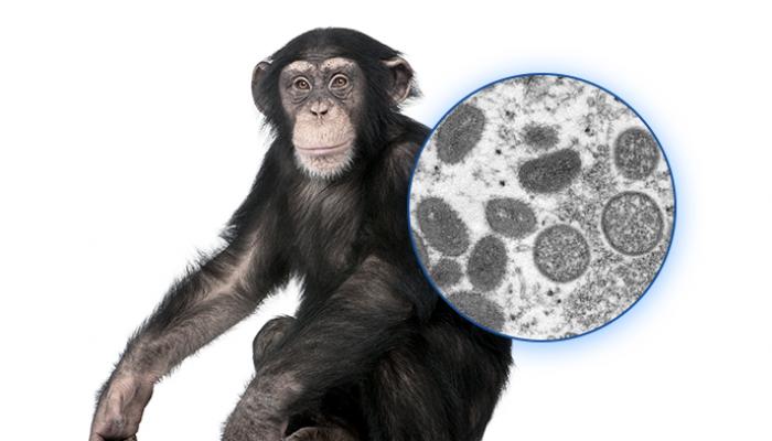 جدري القرود.. ما فترة حضانة الفيروس داخل جسم المصاب؟
