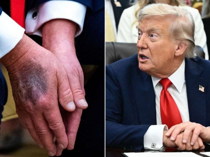 وسم “ترامب ميت” يتصدر منصات التواصل وترقب للكشف عن أسباب تغيبه