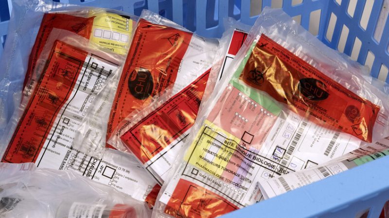 “فضيحة صحية”.. داء “الليستريات” يتفشى في فرنسا والسلطات تتحرك بعد وفاة شخصين وإصابة 21 آخرين