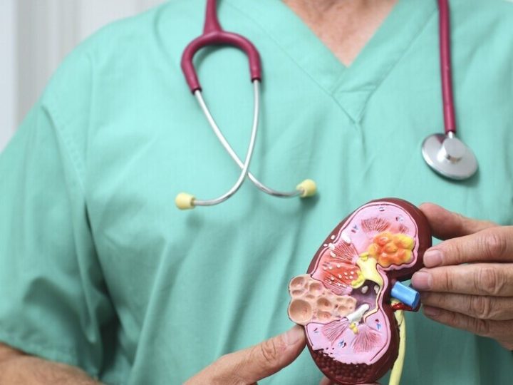 علامات خفية لأمراض الكلى