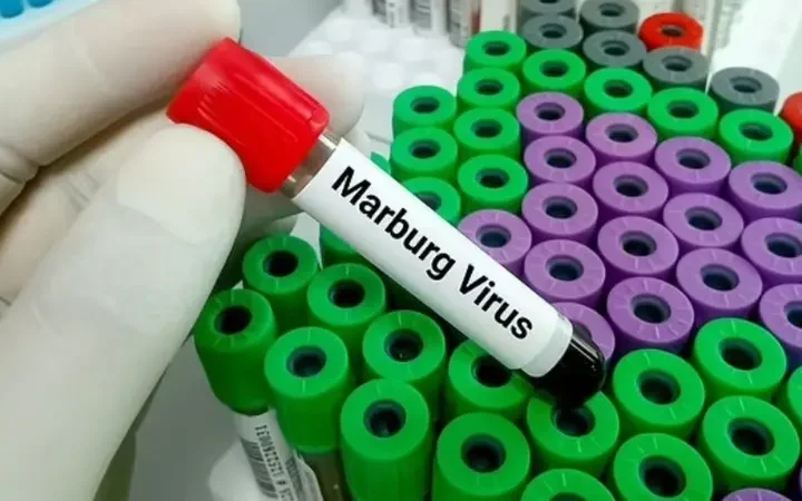 بعد انتشاره في إثيوبيا.. ماذا نعرف عن فيروس “ماربورغ” القاتل ؟